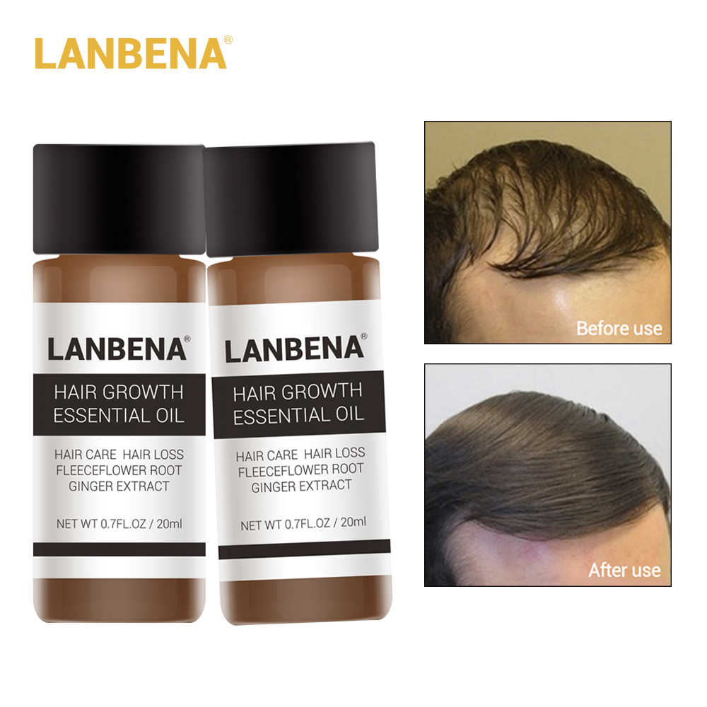 LANBENA-علاج تساقط الشعر
